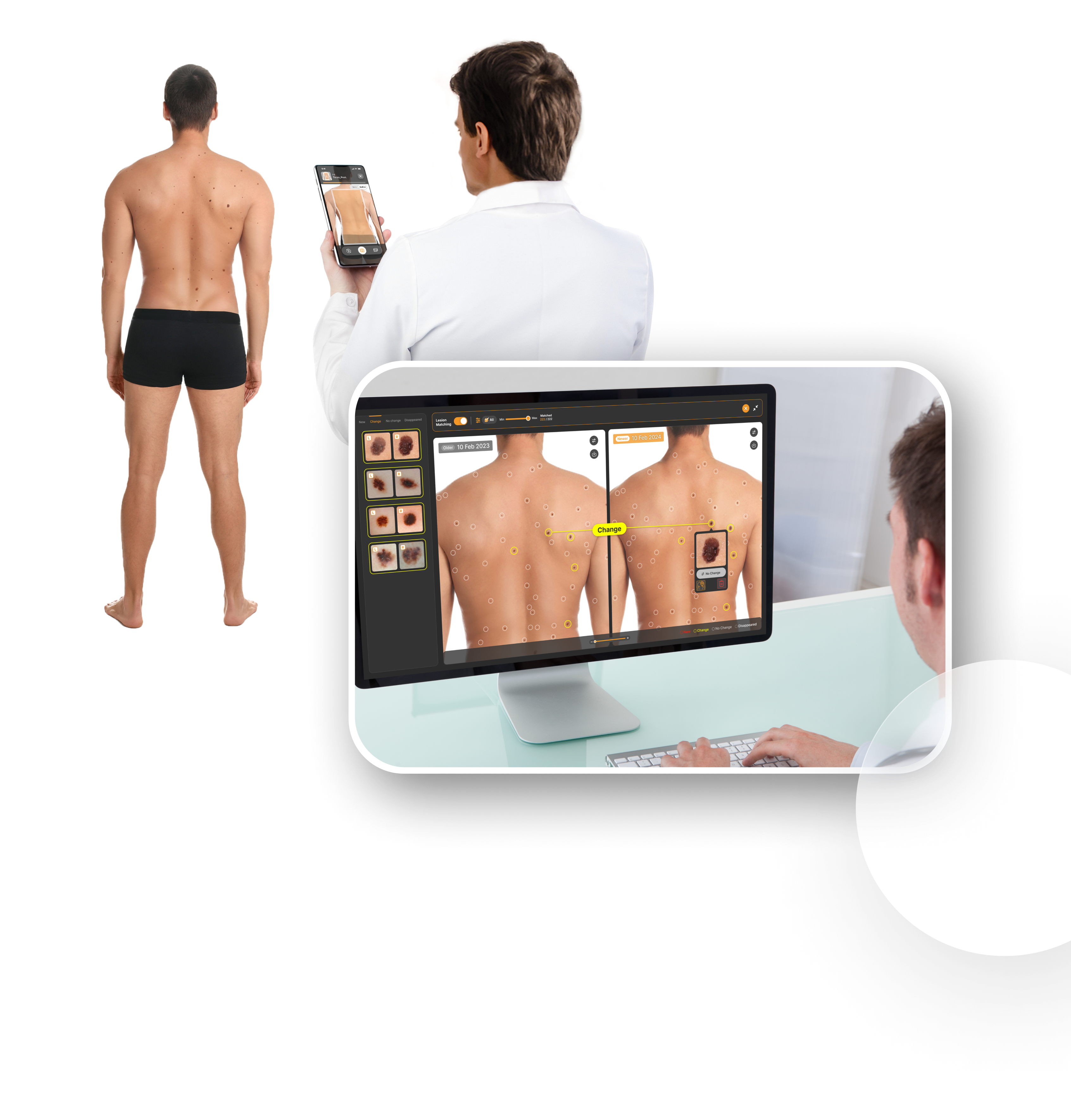 TBP analysis screen that captures total body photography images using a smartphone and analyzes changes in dots by comparing them to past images