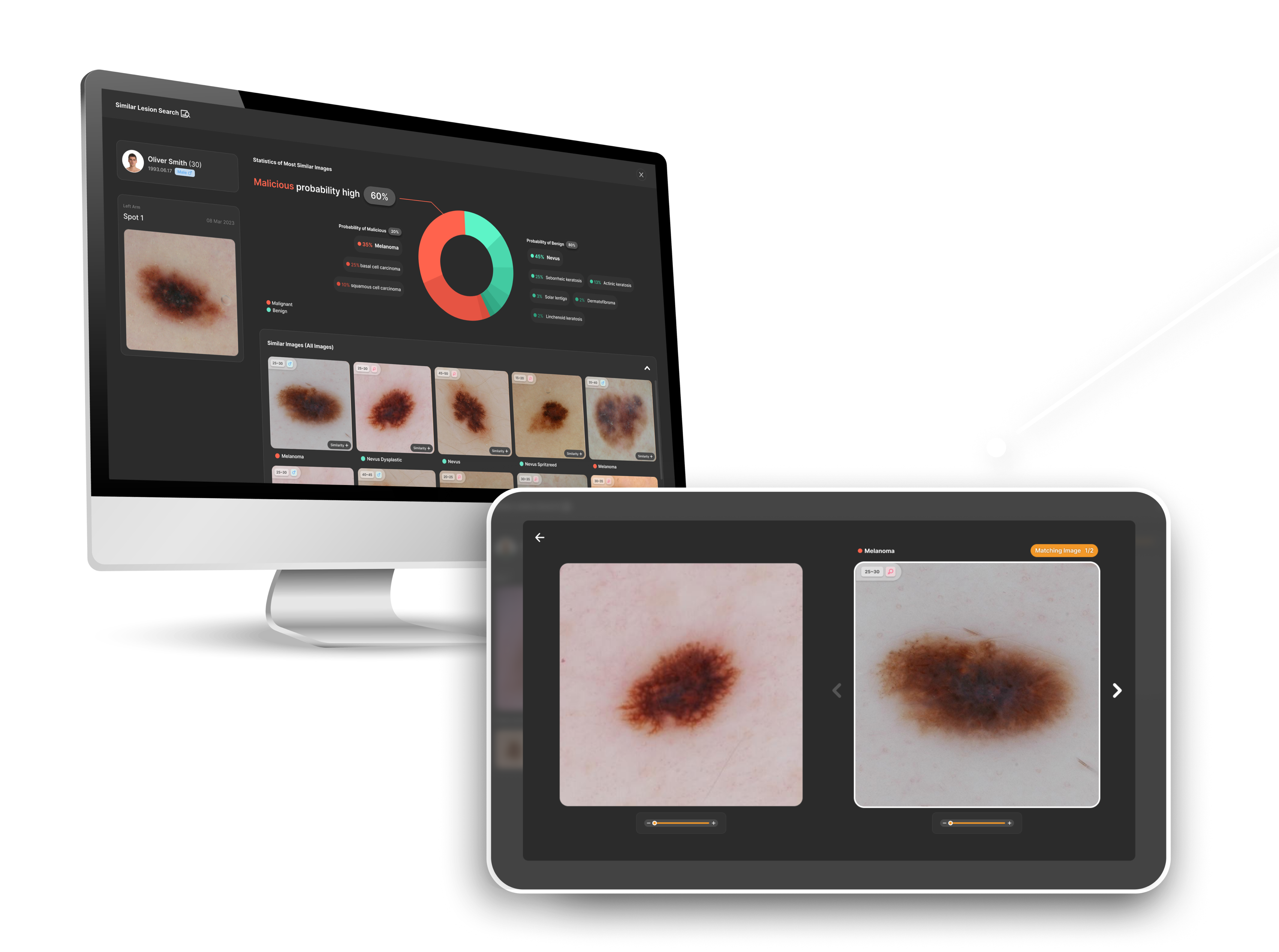 Utilize visual search technology, the Similar Lesion Search features screen for analyzing images with high similarity and disease information labeled on each image