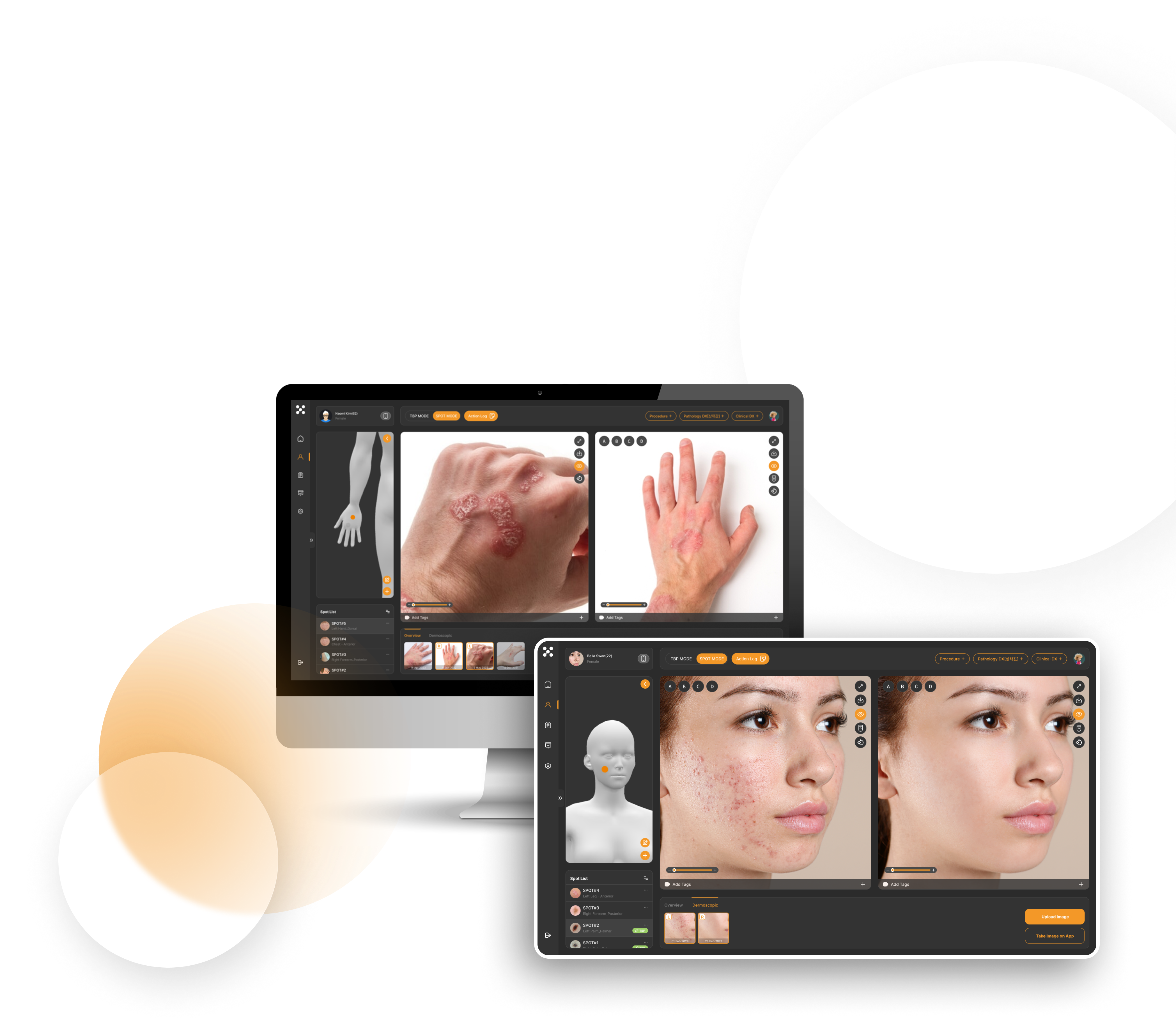 DERMAP’s intuitive image documentation feature screen to easily track and monitor General Dermatology skin diseases