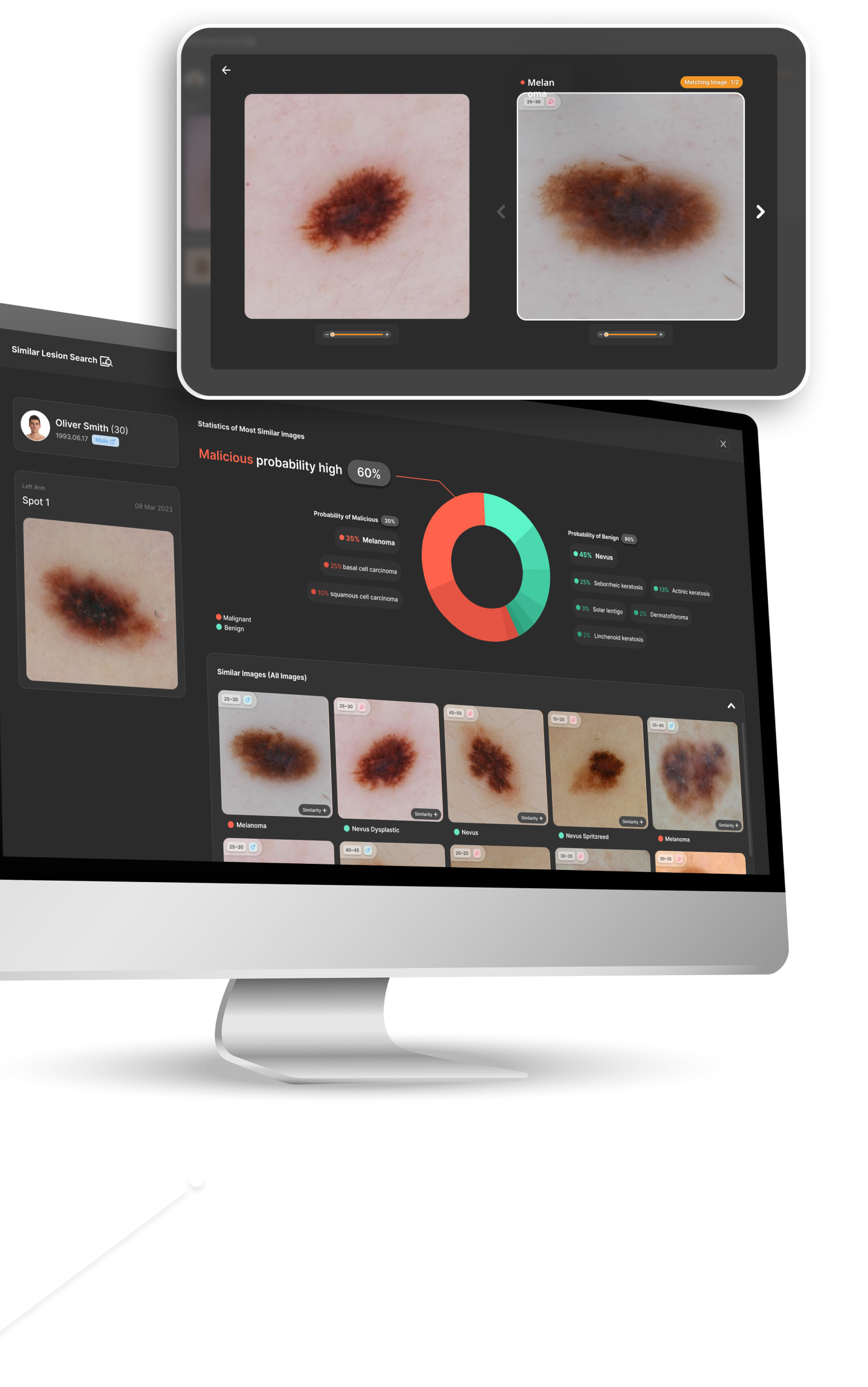 Utilize visual search technology, the Similar Lesion Search features screen for analyzing images with high similarity and disease information labeled on each image